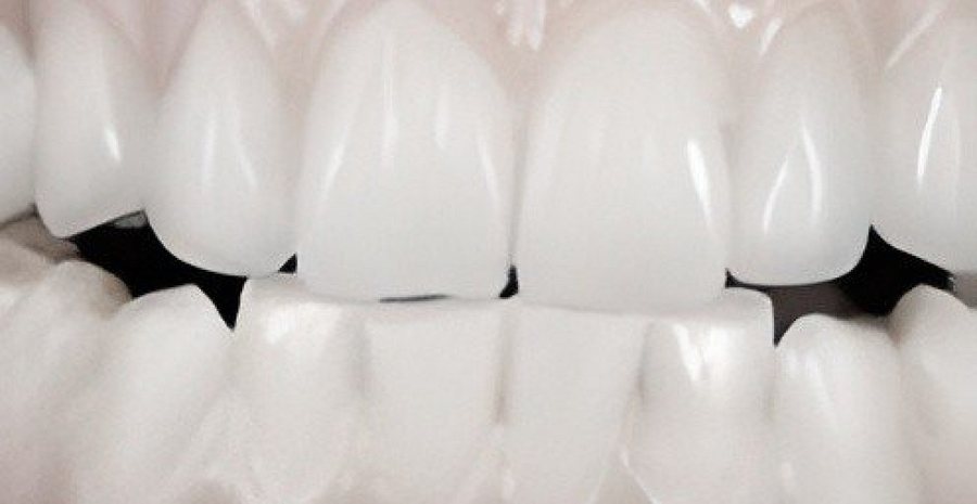 The “Steger Method“ for dental abrasive measurements