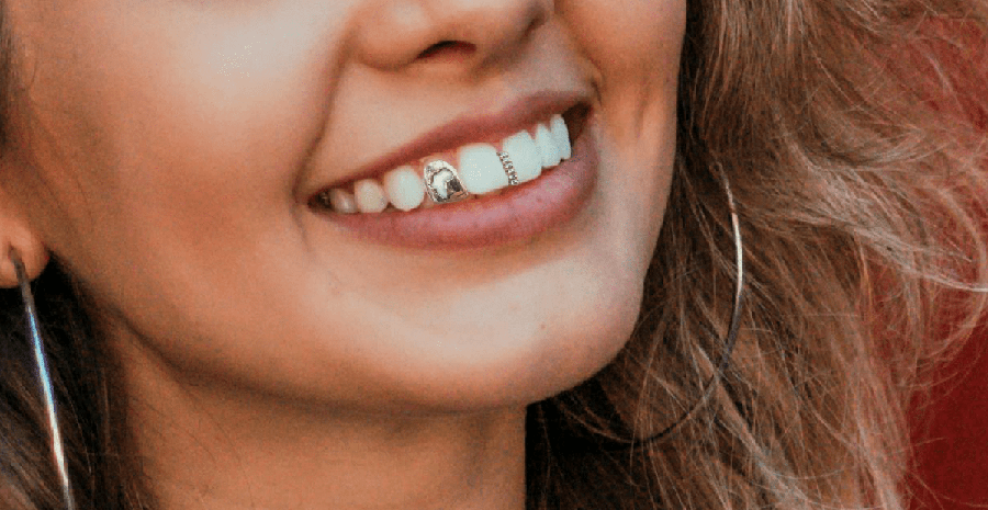 A Grillz fogak története