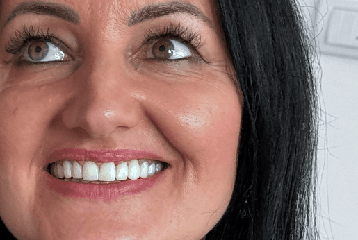 The advantages of Prettau and full zirconia dental restorations – Why choose this modern solution?