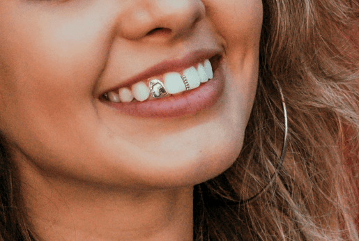 Die Geschichte der Grillz-Zähne